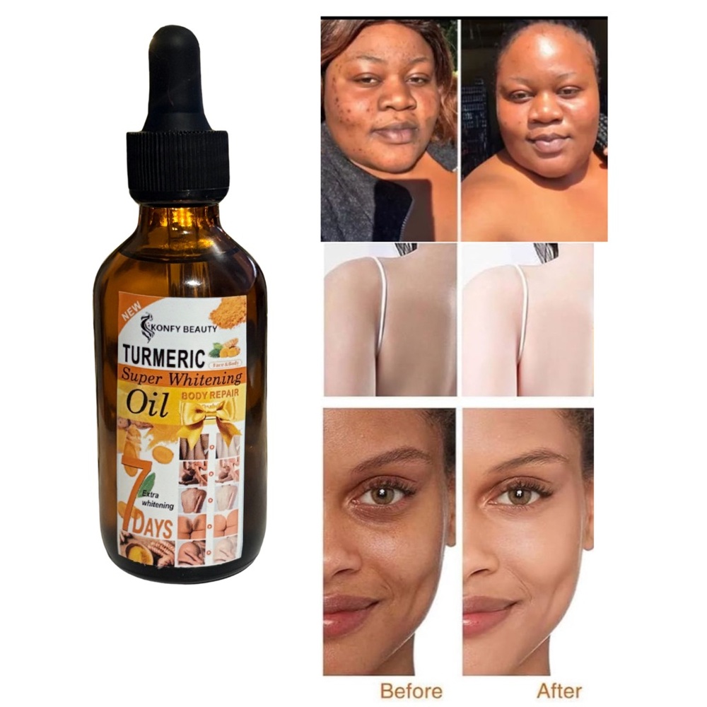 Turmeric oil for body n face